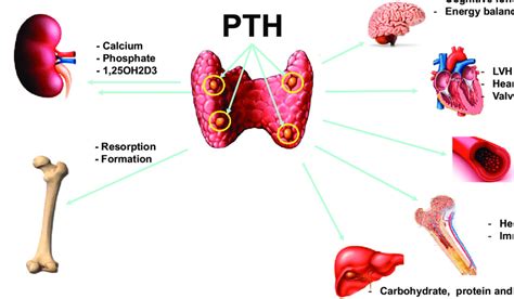 Secondary Hyperparathyroidism What Is It And How Is It Off