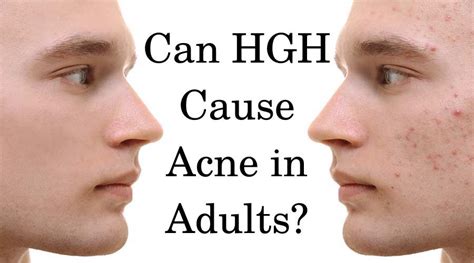 What Does HGH Do to Your Face and Head? | HFS Clinic [HGH & TRT]