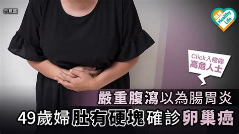 嚴重腹瀉以為腸胃炎 49歲婦肚有硬塊確診卵巢癌 晴報 健康 女性疾病 D190822