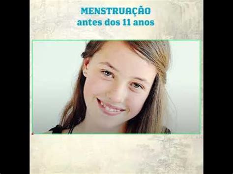 É Normal Menstruar Com 11 Anos - Menstruação antes dos 11 anos | Ivan Bonaldo - YouTube