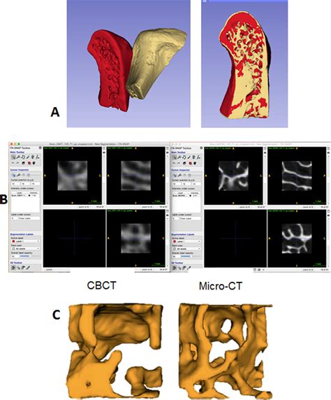 Figure 1 From ACCURACY OF BIOMARKERS OBTAINED FROM CONE BEAM COMPUTED