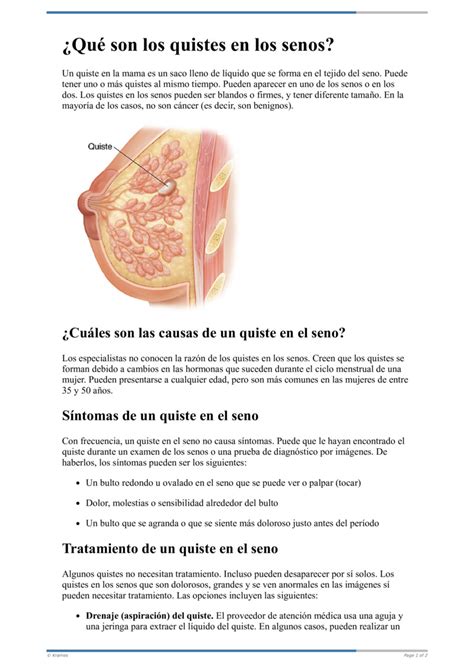 Text Qu Son Los Quistes En Los Senos Healthclips Online