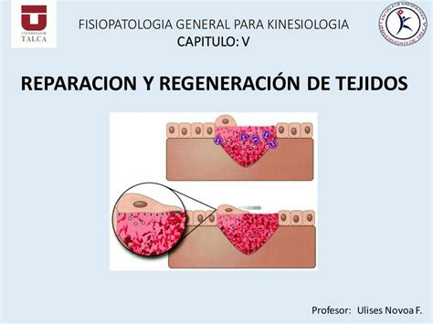 Cap V Reparación y regeneración de tejidos Héctor Castro uDocz