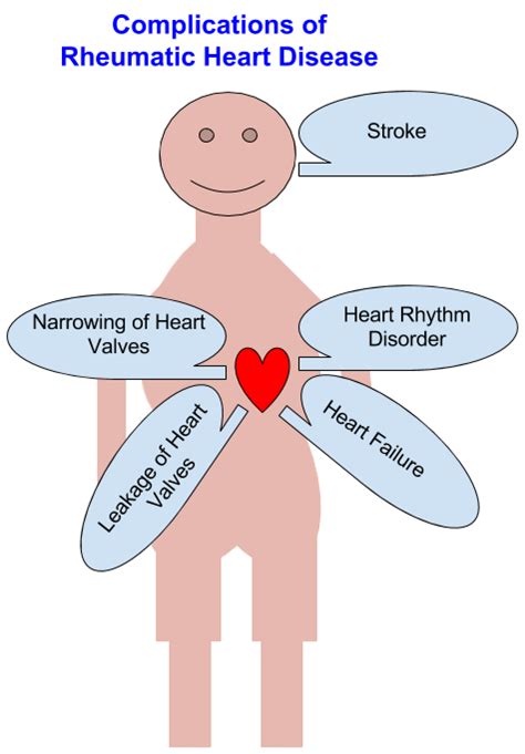 Rheumatic Heart Disease X Ray