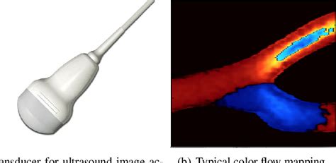 Reconstruction Of Blood Flows From Doppler Images Semantic Scholar