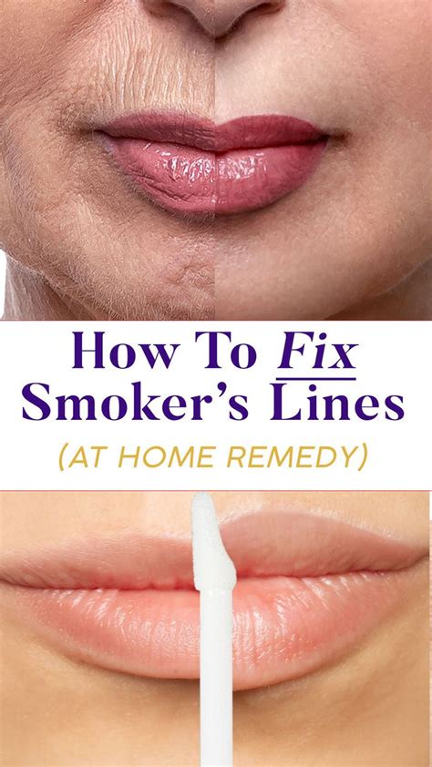 How To Maintain Healthy Luminous Lips In Smokers Lines