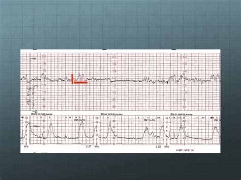 Cardiotocography