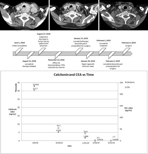 Axial Contrast Enhanced Computed Tomography Scans Prelenvatinib Therapy