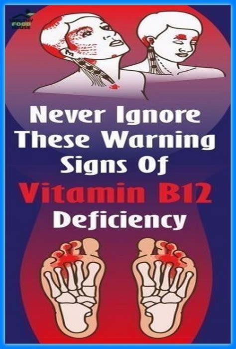 5 Warning Signs Of Vitamin B12 Deficiency You Should Never Ignore