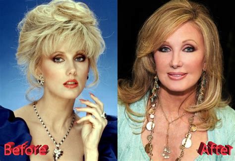 Morgan Fairchild Plastic Surgery A Beautiful Soap Opera Queen