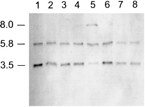 Hybridization Of The Dig Labeled S Hyodysenteriae Isolate B Pf Flaa