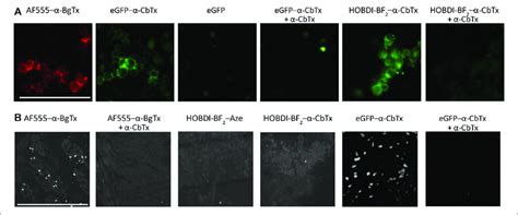 Fluorescence Microscopy Of Neuro A Cells Transfected With Human