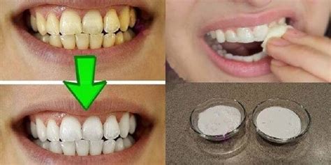 Clareie Seus Dentes Em Menos De 3 Minutos Receitas Naturais