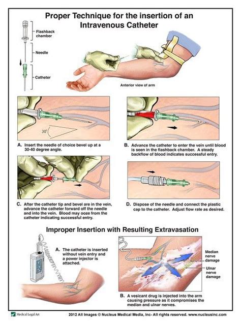 150 best images about Nursing - injections and IV solutions on Pinterest