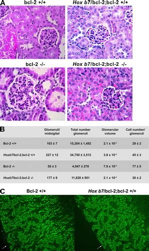 Rescue Of Renal Hypoplasia And Cystic Dysplasia In Bcl‐2 −− Mice Expressing Bcl‐2 In Ureteric