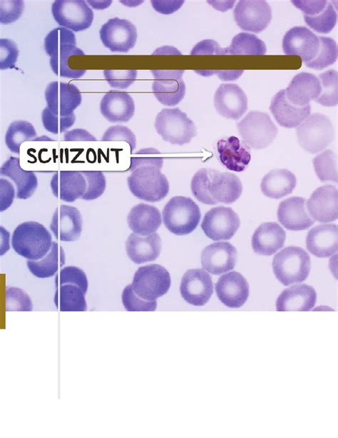 Plasmodium species (Malaria) | Osmosis