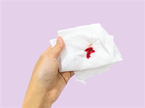 Causes Of Bleeding During And After Sex Flo