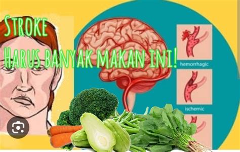 Penderita Stroke Harus Banyak Makan Ini