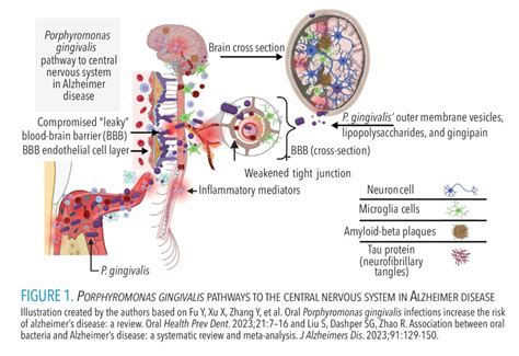 Emerging Discoveries on the Pathogenicity of Porphyromonas Gingivalis ... 