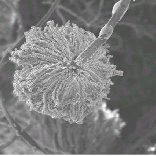 Aspergillus flavus as seen under the scanning microscope; magnified by... | Download Scientific ...