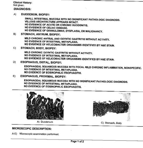 Official endoscopy results : r/Gastritis