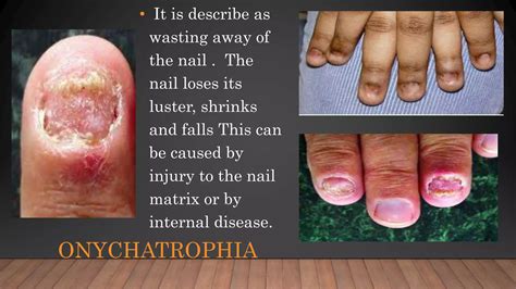 Nail diseases and disorders | PPT