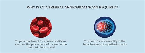 CT Cerebral Angiogram Scan Price | CT Cerebral Angiogram Scan starts at ...