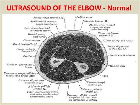 Presentation1.pptx, ultrasound examination of the elbow joint.