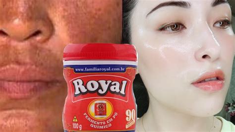 Pele de Bebê em 2 Dias Use pó Royal e Diga Adeus às manchas