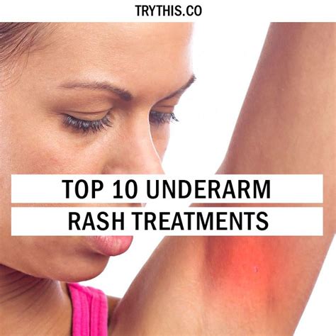 No More Itchy Armpits Top 10 Underarm Rash Treatments Rash Treatment Underarm Rash Armpit Rash