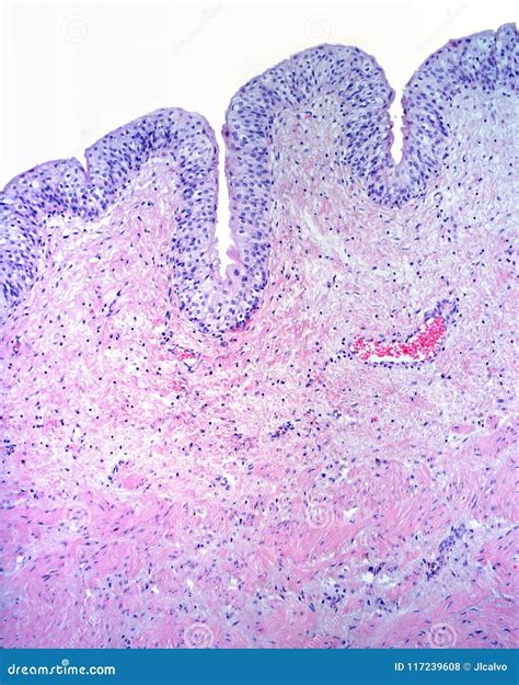 Urinary bladder mucosa stock photo. Image of histology - 117239608