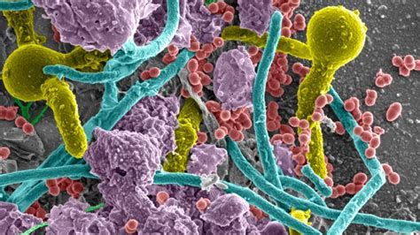 Polymicrobial Infection Image Eurekalert Science News Releases