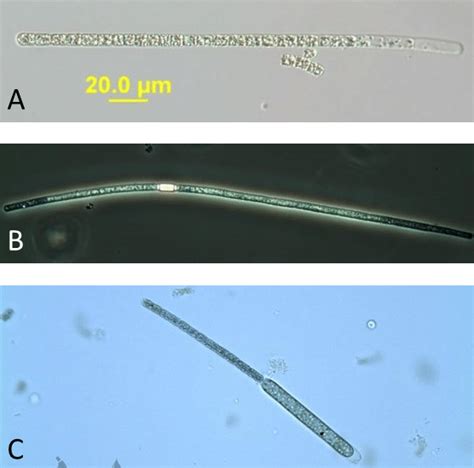 Figure A Aphanizomenon Flos Aquae A Nomarski B Phase C