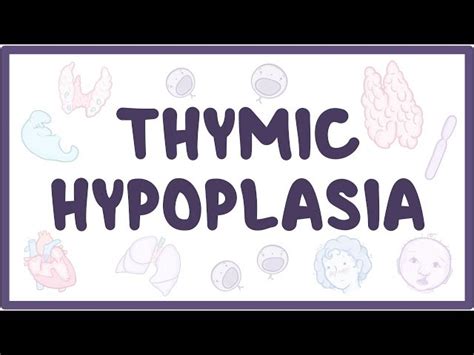 Thymic Hypoplasia - Causes, Symptoms, Diagnosis, Treatment, Pathology - 2024