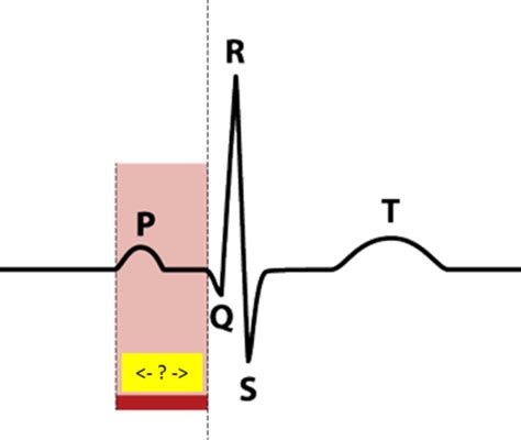 Patho Cardio Pics Flashcards Quizlet