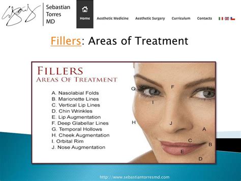 PPT - Injectable Fillers for The Face Before and After PowerPoint ...