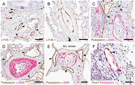 Staining Characteristics Of Immunohistochemical Markers For Detection