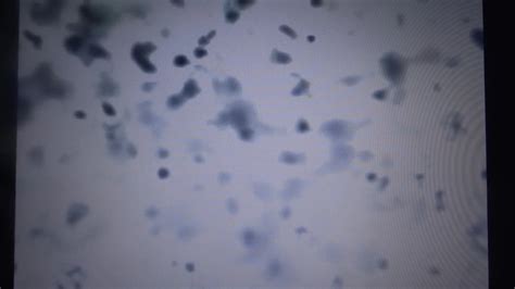 Orgasm With Dilator Sperm Microscope Gay Man Porn XHamster