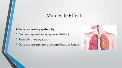 PPT - General Anaesthesia PowerPoint Presentation, free download - ID:2235618