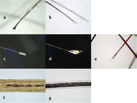 Microscopic images of a human and a non-human medulla and human hair ...