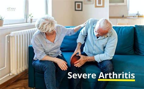 What is Severe Arthritis? Symptoms, Causes and Treatment