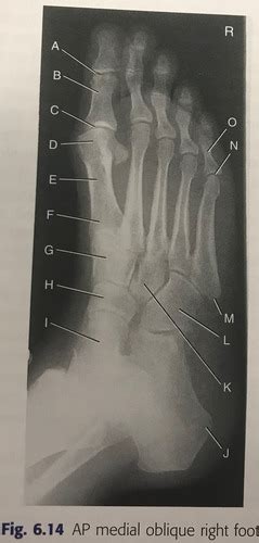 Unit 3 Lower Limb Knee Tib Fib Ankle Foot Toes Flashcards Quizlet