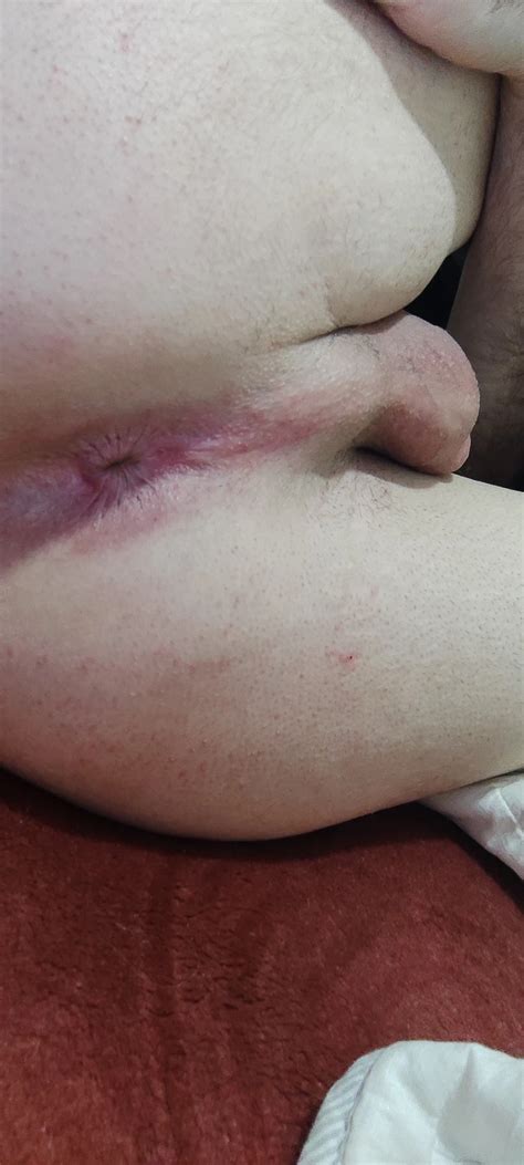 Nude Bikini Pantyhose Nude Pics XHamster