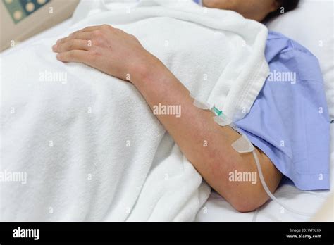 Female Patient With Dengue Fever Red Rashes Stay On A Hospital Bed