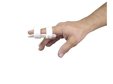 Ulnar Gutter Splint Boxer Fracture Of The Pinky And Ring