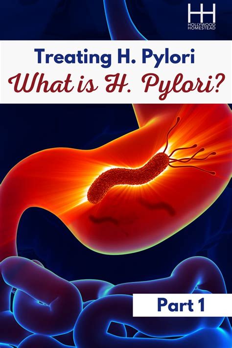 TREATING H PYLORI (PART 1): WHAT IS H PYLORI? | Stomach ulcers, Small intestine bacterial ...