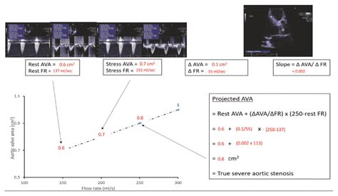 Figure Projected Aortic Valve Area Calculation Derived From Resting