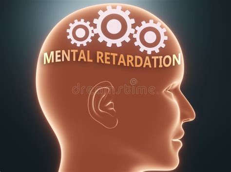 Retardo Mental E Mente Humana Representados Como Retardo Mental Vocal