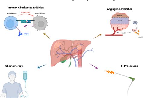 Figure 1 From Potential Immunotherapy Targets For Liver Directed Therapies And The Current