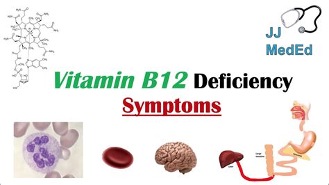 Vitamin B Deficiency Diseases